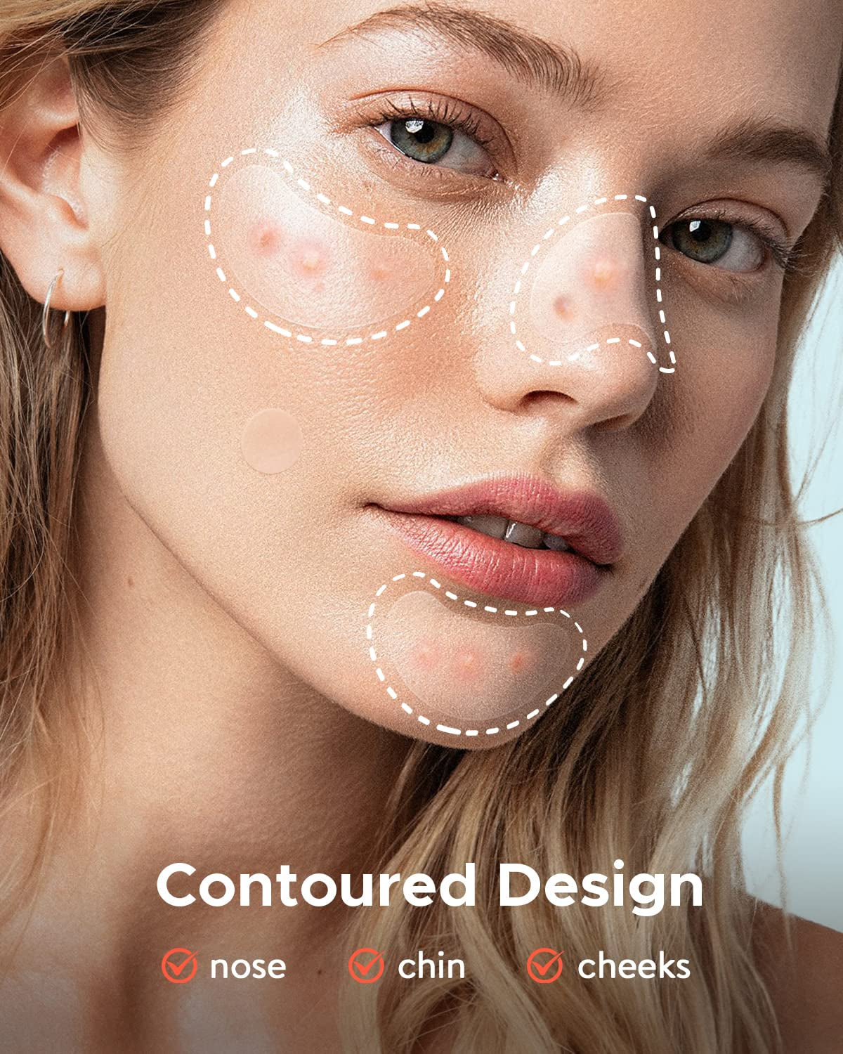 Acne Patches Large, Hydrocolloid Pimple Patches for Breakouts, Zit and Blemish, Acne Patches for Face, Chin, Back and Body with Tea Tree Oil