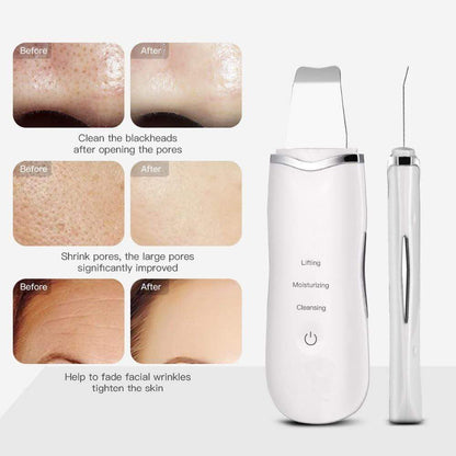 Ultrasonic Deep Facial Cleanser & Face Scrubber Device